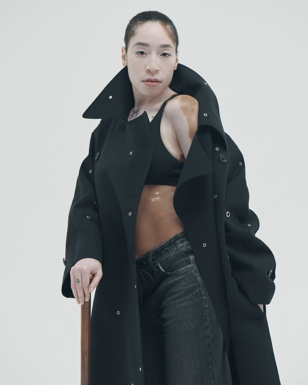 Jesi Taylor On vitiligo, a cane, and the maxi dress that does all the work